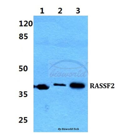 Anti-RASSF2 Antibody from Bioworld Technology (BS5884) - Antibodies.com