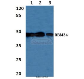 Anti-RBM34 Antibody from Bioworld Technology (BS5885) - Antibodies.com