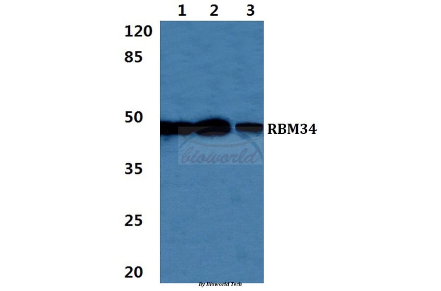 Anti-RBM34 Antibody from Bioworld Technology (BS5885) - Antibodies.com