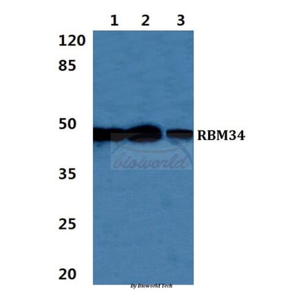 Anti-RBM34 Antibody from Bioworld Technology (BS5885) - Antibodies.com