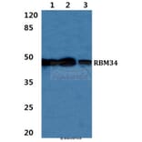 Anti-RBM34 Antibody from Bioworld Technology (BS5885) - Antibodies.com