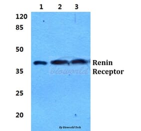 Anti-Renin Receptor Antibody from Bioworld Technology (BS5887) - Antibodies.com