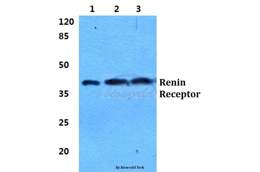 Anti-Renin Receptor Antibody from Bioworld Technology (BS5887) - Antibodies.com