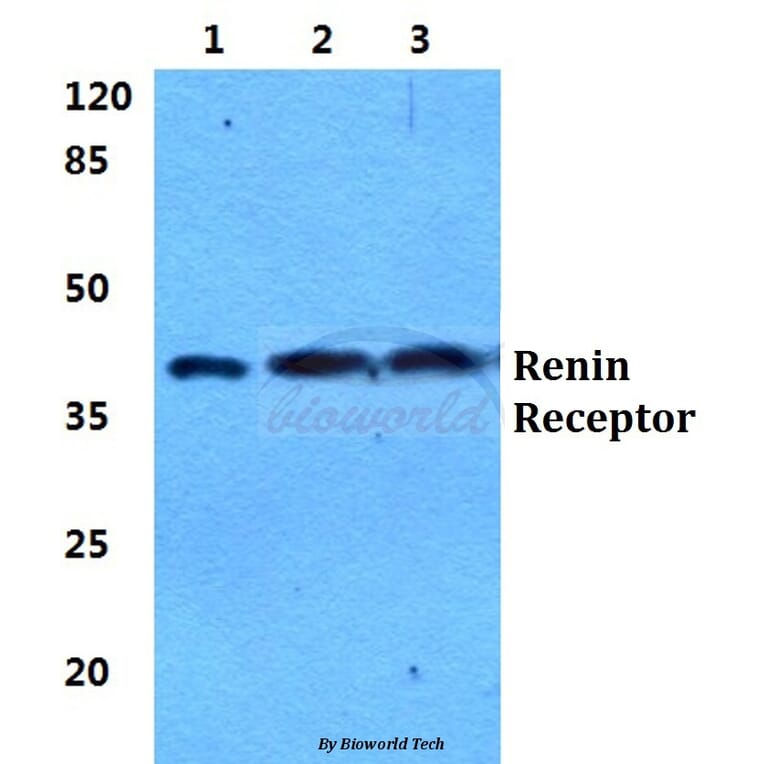 Anti-Renin Receptor Antibody from Bioworld Technology (BS5887) - Antibodies.com