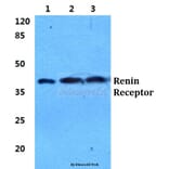 Anti-Renin Receptor Antibody from Bioworld Technology (BS5887) - Antibodies.com