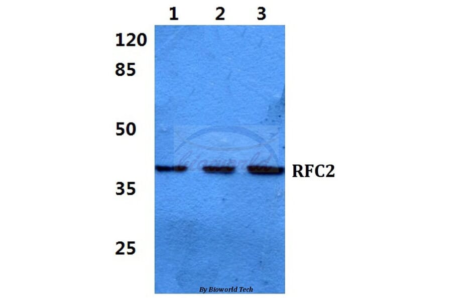 Anti-RFC2 Antibody from Bioworld Technology (BS5892) - Antibodies.com