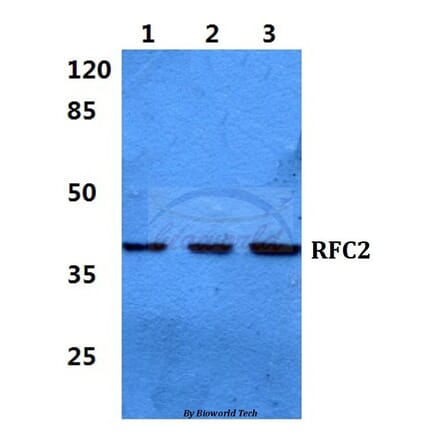Anti-RFC2 Antibody from Bioworld Technology (BS5892) - Antibodies.com