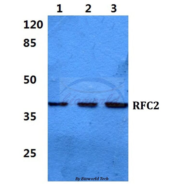 Anti-RFC2 Antibody from Bioworld Technology (BS5892) - Antibodies.com