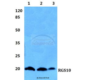 Anti-RGS10 Antibody from Bioworld Technology (BS5895) - Antibodies.com