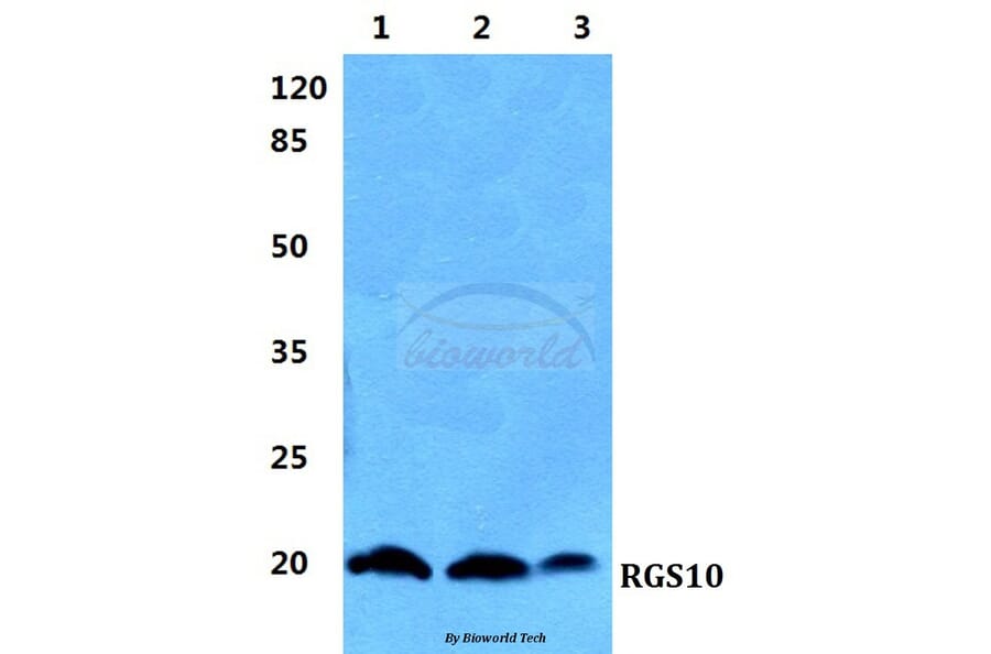 Anti-RGS10 Antibody from Bioworld Technology (BS5895) - Antibodies.com