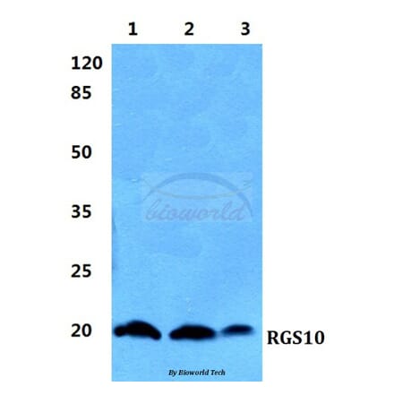 Anti-RGS10 Antibody from Bioworld Technology (BS5895) - Antibodies.com