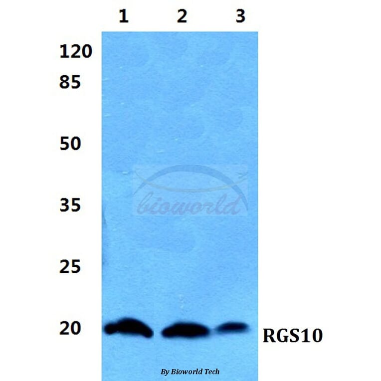 Anti-RGS10 Antibody from Bioworld Technology (BS5895) - Antibodies.com