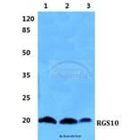 Anti-RGS10 Antibody from Bioworld Technology (BS5895) - Antibodies.com