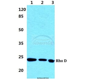 Anti-Rho D Antibody from Bioworld Technology (BS5898) - Antibodies.com