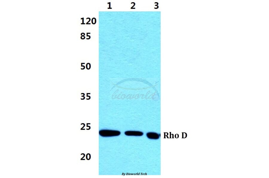 Anti-Rho D Antibody from Bioworld Technology (BS5898) - Antibodies.com