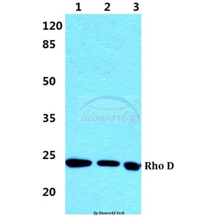 Anti-Rho D Antibody from Bioworld Technology (BS5898) - Antibodies.com