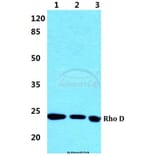 Anti-Rho D Antibody from Bioworld Technology (BS5898) - Antibodies.com