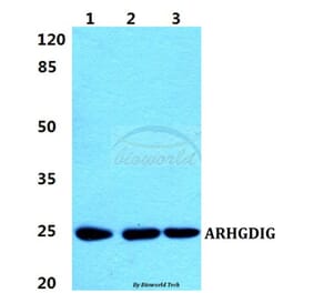 Anti-ARHGDIG Antibody from Bioworld Technology (BS5899) - Antibodies.com