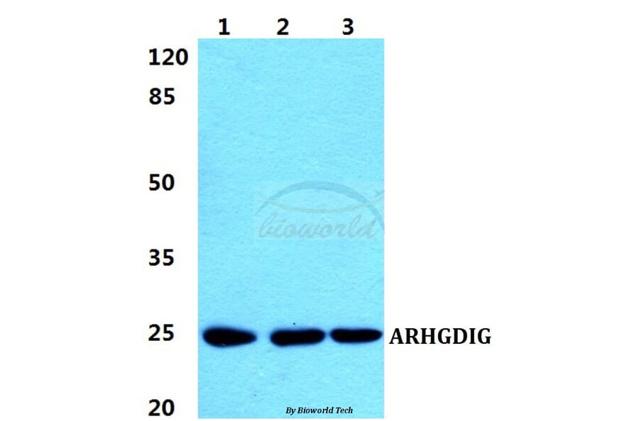 Anti-ARHGDIG Antibody from Bioworld Technology (BS5899) - Antibodies.com