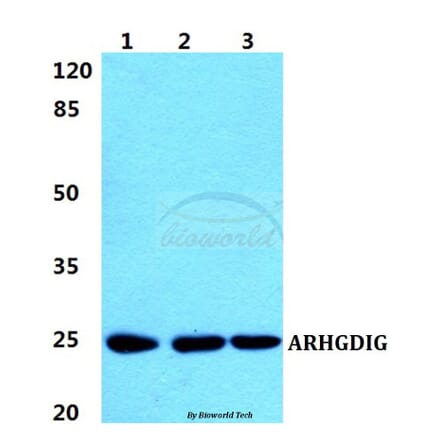 Anti-ARHGDIG Antibody from Bioworld Technology (BS5899) - Antibodies.com