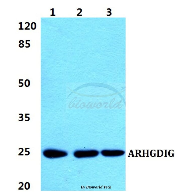 Anti-ARHGDIG Antibody from Bioworld Technology (BS5899) - Antibodies.com