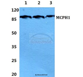 Anti-Microcephalin Antibody from Bioworld Technology (BS5900) - Antibodies.com