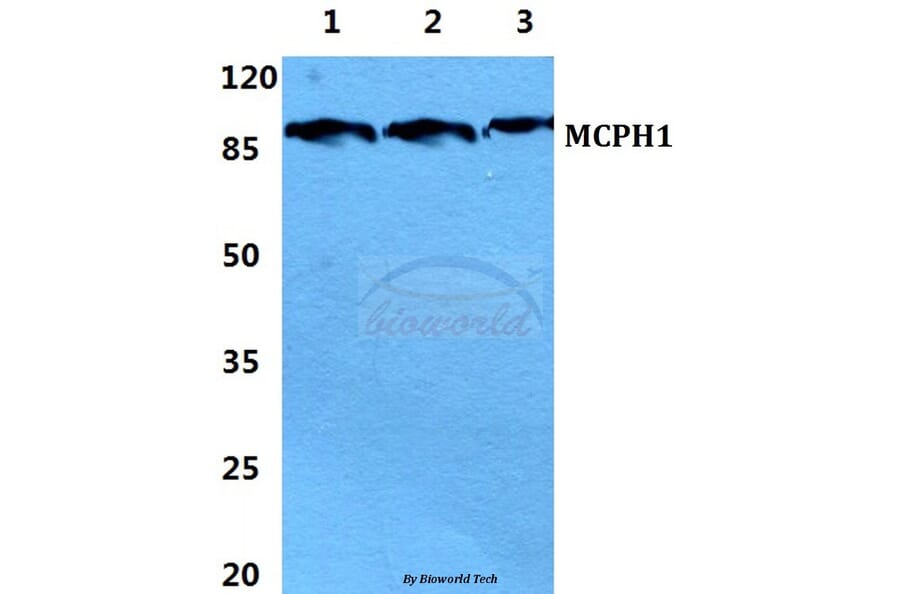 Anti-Microcephalin Antibody from Bioworld Technology (BS5900) - Antibodies.com