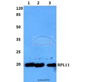 Anti-RPL11 Antibody from Bioworld Technology (BS5902) - Antibodies.com