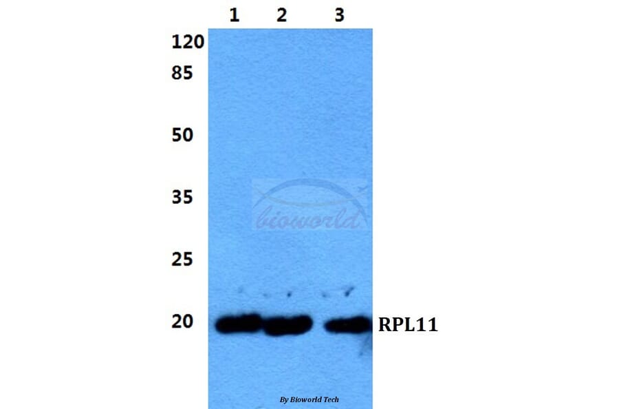 Anti-RPL11 Antibody from Bioworld Technology (BS5902) - Antibodies.com