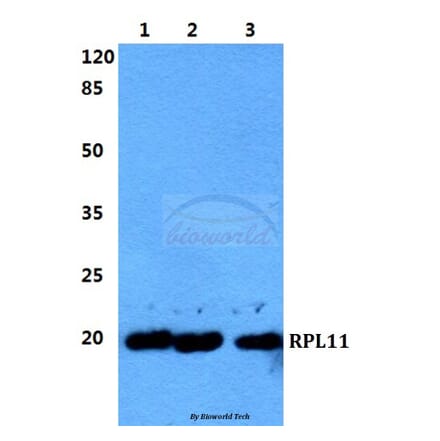 Anti-RPL11 Antibody from Bioworld Technology (BS5902) - Antibodies.com