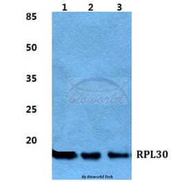 Anti-RPL30 Antibody from Bioworld Technology (BS5905) - Antibodies.com