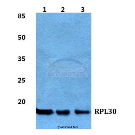 Anti-RPL30 Antibody from Bioworld Technology (BS5905) - Antibodies.com