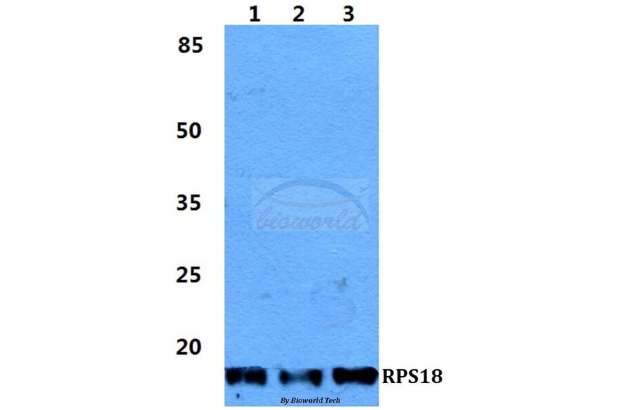 Anti-RPS18 Antibody from Bioworld Technology (BS5906) - Antibodies.com