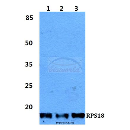 Anti-RPS18 Antibody from Bioworld Technology (BS5906) - Antibodies.com