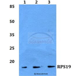Anti-RPS19 Antibody from Bioworld Technology (BS5907) - Antibodies.com