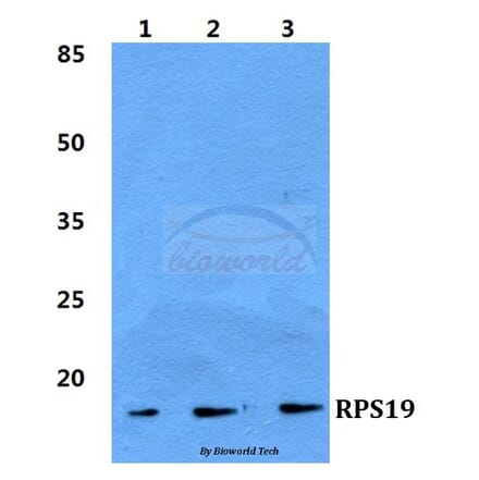 Anti-RPS19 Antibody from Bioworld Technology (BS5907) - Antibodies.com
