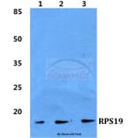 Anti-RPS19 Antibody from Bioworld Technology (BS5907) - Antibodies.com