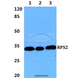 Anti-RPS2 Antibody from Bioworld Technology (BS5908) - Antibodies.com