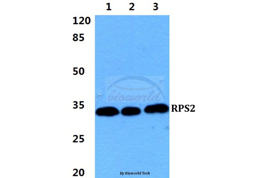 Anti-RPS2 Antibody from Bioworld Technology (BS5908) - Antibodies.com
