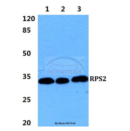 Anti-RPS2 Antibody from Bioworld Technology (BS5908) - Antibodies.com