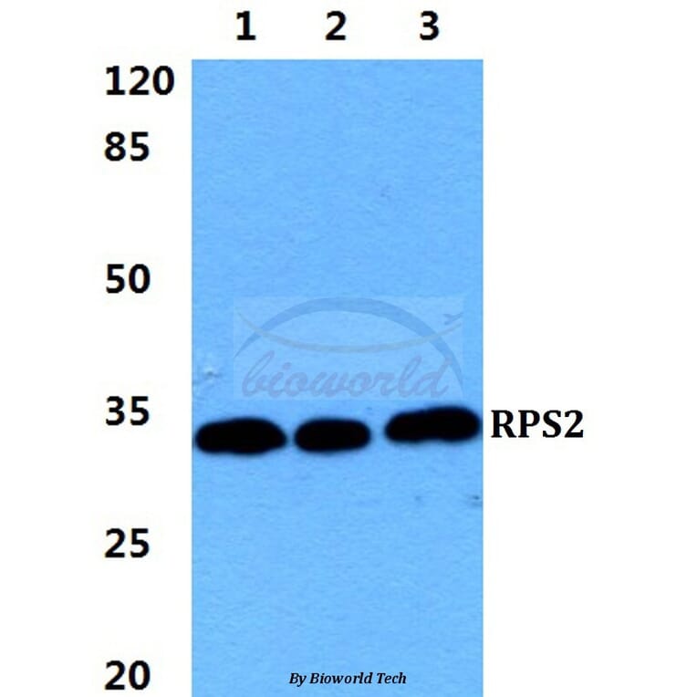 Anti-RPS2 Antibody from Bioworld Technology (BS5908) - Antibodies.com