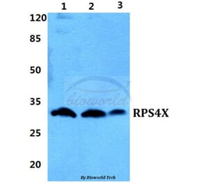 Anti-RPS4X Antibody from Bioworld Technology (BS5910) - Antibodies.com