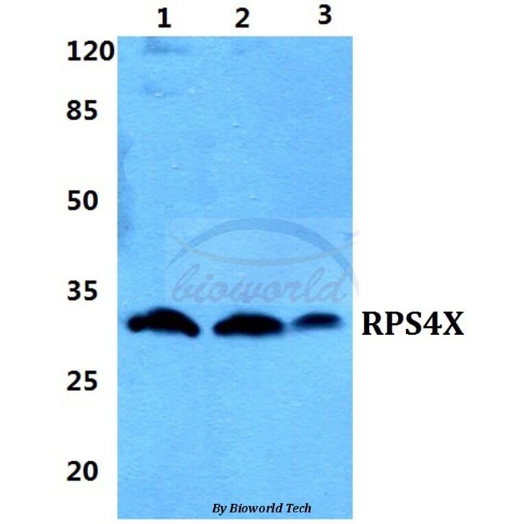 Anti-RPS4X Antibody from Bioworld Technology (BS5910) - Antibodies.com
