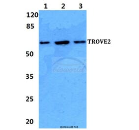 Anti-TROVE2 Antibody from Bioworld Technology (BS5914) - Antibodies.com