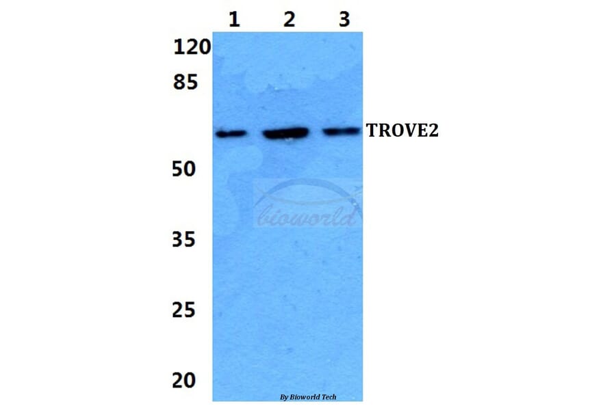 Anti-TROVE2 Antibody from Bioworld Technology (BS5914) - Antibodies.com