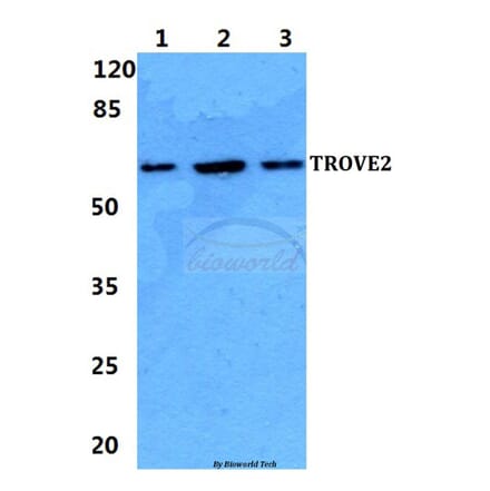 Anti-TROVE2 Antibody from Bioworld Technology (BS5914) - Antibodies.com