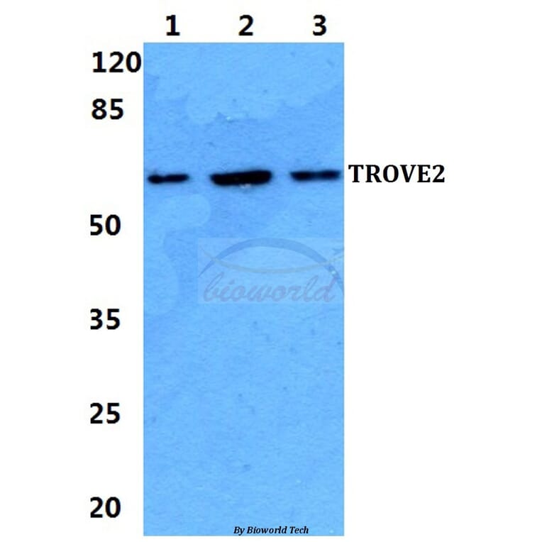 Anti-TROVE2 Antibody from Bioworld Technology (BS5914) - Antibodies.com