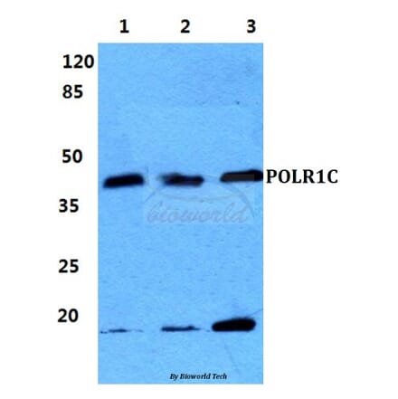 Anti-POLR1C Antibody from Bioworld Technology (BS5916) - Antibodies.com