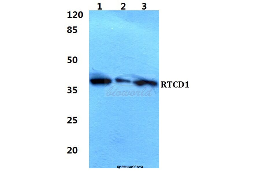 Anti-RTCD1 Antibody from Bioworld Technology (BS5918) - Antibodies.com