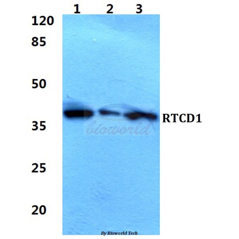 Anti-RTCD1 Antibody from Bioworld Technology (BS5918) - Antibodies.com